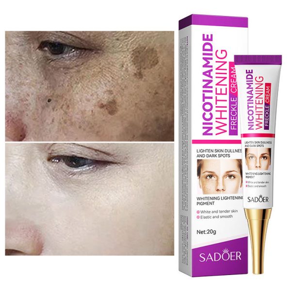 Nicotinamide Whitening Freckles Cream Remove Melasma Dark Spot