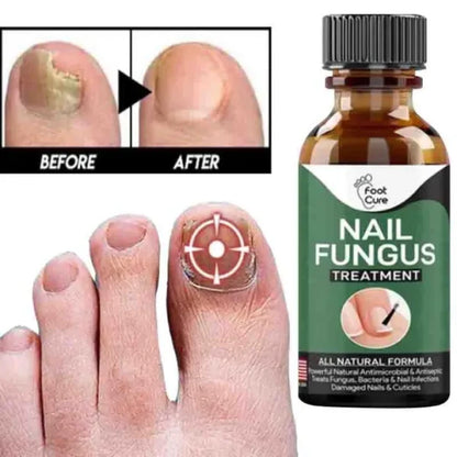 Fast Nail Fungal Treatments