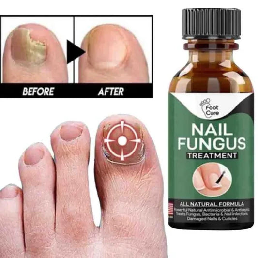 Fast Nail Fungal Treatments