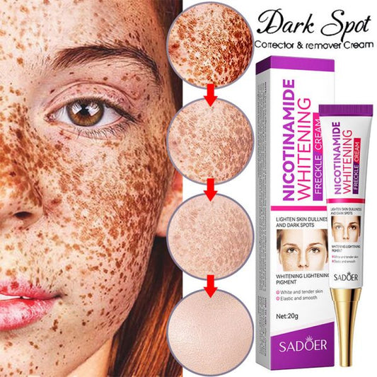 Nicotinamide Whitening Freckles Cream Remove Melasma Dark Spot