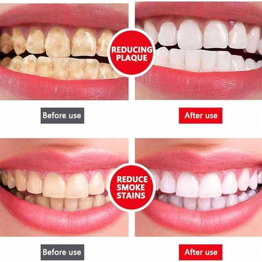 Yayashi Sp-4 Ultra Whitening Toothpaste